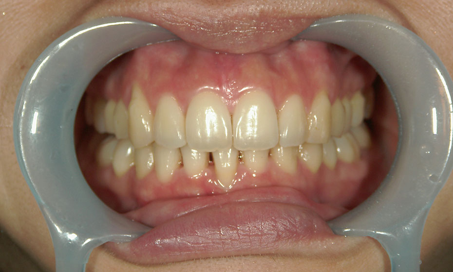 歯列矯正治療の失敗と再治療―臨床現場からのレポート 菅原 準二の+ 